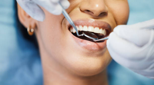 Best Emergency Gum Pain Relief  in Fort Clark Springs, TX