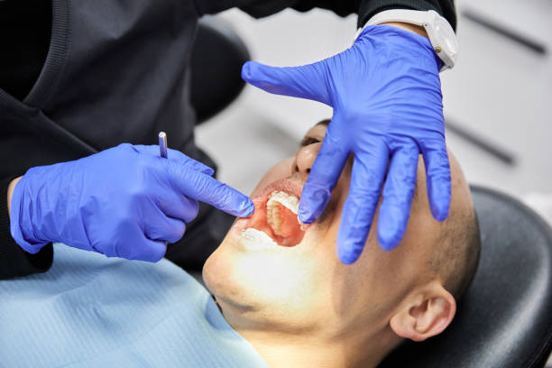 Best Chipped Tooth Repair Near Me  in Fort Clark Springs, TX